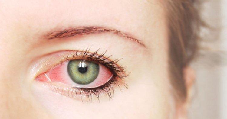 Grandlakeeyecarellc.com/Reprodução Grandlakeeyecarellc.com/Reprodução