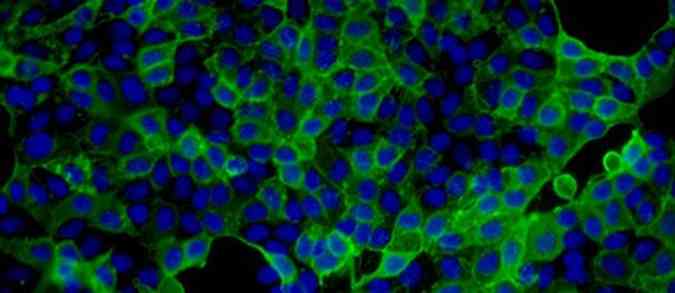 Clulas de amostras humanas infectadas pelo vrus chikungunya com a fluorescncia produzida durante o isolamento do vrus na Fiocruz do Paran (foto: Fiocruz/Divulgao)