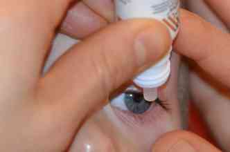 Segundo o oftalmologista Jonathan Lake, o uso irregular de colrios, como os adstringentes, que deixam os glbulos mais brancos, pode causar catarata(foto: Pixabay)