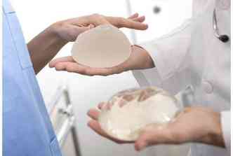 Como mostra o especialista, no existe prazo de validade para o implante de silicone, ainda mais os que vm sendo usados atualmente(foto: Breastimplantinfo.org/Reproduo)