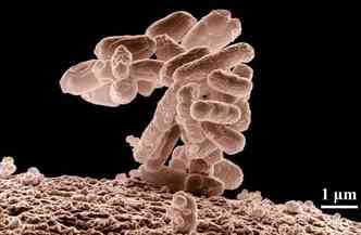 A OMS listou 12 bactrias causadoras de infeces comuns, como a pneumonia, que esto se tornando muito resistentes e precisam de novos agentes de combate urgentemente(foto: Pixabay)