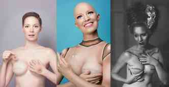 Nas fotos da campanha My Breast Choice, a atriz americana Aniela McGuinnes mostra as etapas que levaram  sua dupla mastectomia preventiva(foto: Instagram/anielamcg/Reproduo)