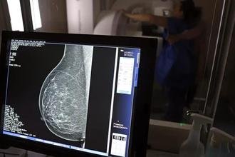 M�dicos lan�am guia para evitar recusa de mamografia digital