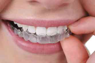 A novidade da odontologia  o uso de aparelho 