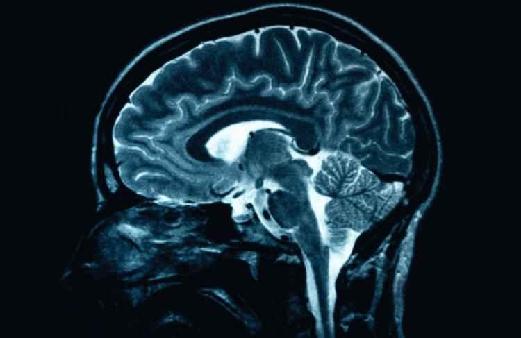 Infokid.org.uk/mri/Reprodução Infokid.org.uk/mri/Reprodução