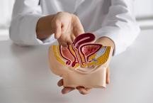 Idade � principal fator de risco para morte por c�ncer colorretal