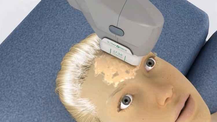 YouTube/Medsystems/Reprodução YouTube/Medsystems/Reprodução