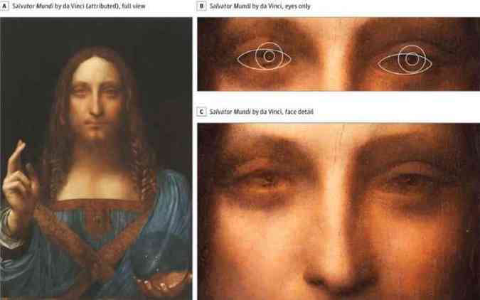 Cientistas analisaram obras que foram baseadas na aparncia de Leonardo Da Vinci e descobriram que o clebre pintor era estrbico(foto: Jamanetwork.com/Reproduo)