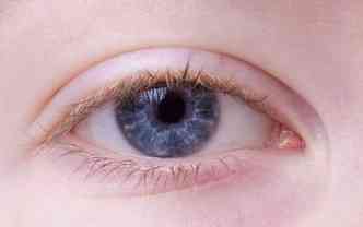 Como mostra a oftalmologista, vrios fatores, como gentica, idade e uso de lentes de contato, podem causar a queda da plpebra - problema conhecido como ptose palpebral(foto: Pixabay)