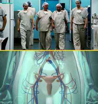 A equipe da rea de ginecologia do Hospital das Clnicas da USP gastou quase 10 h para realizar o transplante de tero indito na Amrica Latina(foto: Globoplay.globo.com/Reproduo)