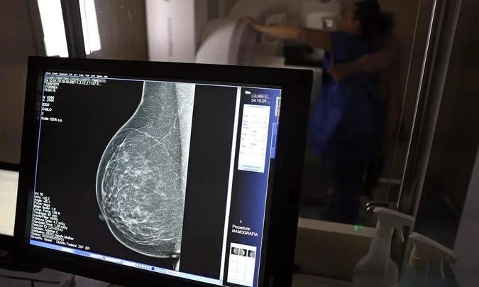 Desde 1º de outubro, os planos de saúde são obrigados a oferecer acesso à mamografia digital sem restrição de idade ou gênero(foto: José Cruz/Agência Brasil) Desde 1º de outubro, os planos de saúde são obrigados a oferecer acesso à mamografia digital sem restrição de idade ou gênero(foto: José Cruz/Agência Brasil)
