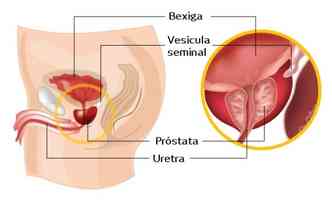 O exame de toque retal  a principal forma de diagnstico para o cncer de prstata, mas esbarra no preconceito masculino(foto: Robotic Oncology/Reproduo)