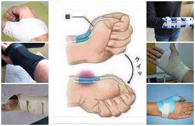 Uma das imagens que est circulando no Facebook mostra o movimento que poderia gerar uma leso no tendo do polegar de forma rpida. Ser?(foto: Facebook/Reproduo)