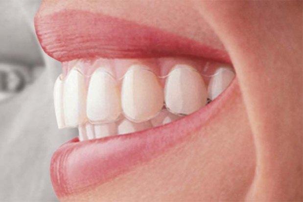 Noveradental.com/Reprodução Noveradental.com/Reprodução