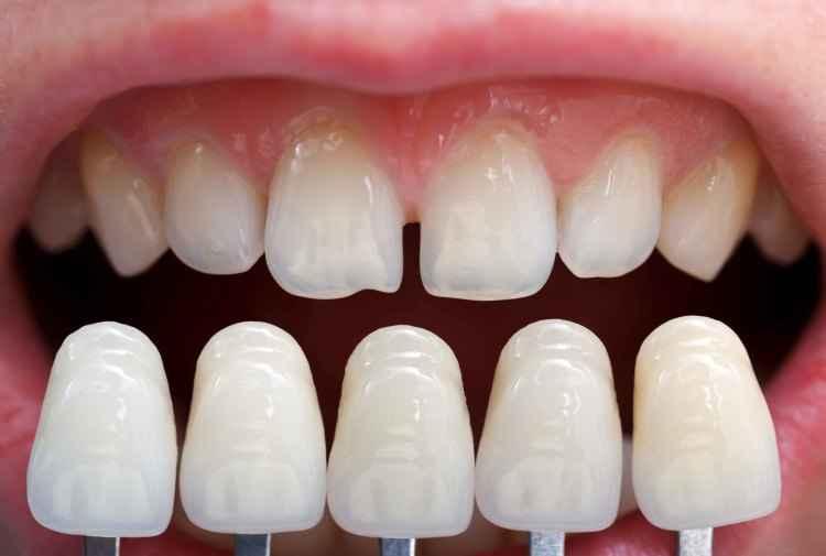 Mcloudfamilydental.com/Reprodução Mcloudfamilydental.com/Reprodução