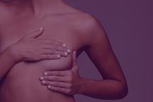 Simpsio internacional rene 26 pases para discutir avanos no cncer de mama