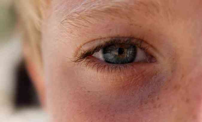 Nos dias mais frios, os olhos podem ser vtimas de vrias doenas, especialmente a conjuntivite e a sndrome do olho seco(foto: Pixabay)