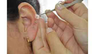 Na auriculoterapia, ao invs de agulhas, so usadas sementes, esferas e cristais para estimular pontos especficos da orelha(foto: Divulgao)