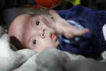 Câncer no olho de bebês pode ser detectado em fotos feitas com flash