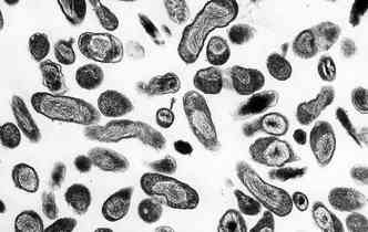 A bactria Coxiella burnetii, causadora da febre Q,  muito resistente e pode ser transmitida aos humanos pelo ar ou pelo contato com secrees de animais domsticos(foto: Wikimedia/Reproduo)