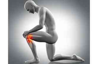 A artrose no joelho causa muita dor e dificuldade na mobilidade dos pacientes. A nova tcnica chamada subcondroplastia pode ajudar quem sofre com esse problema(foto: Freepik)