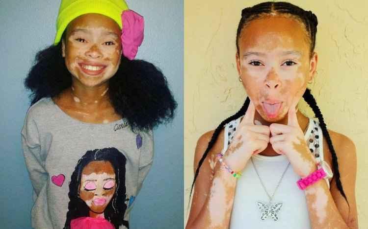 Instagram/redefinedmybeauty/Reprodução Instagram/redefinedmybeauty/Reprodução