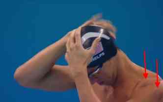 As manchas circulares vermelhas o corpo do nadador Michael Phelps dizem respeito  ventosaterapia, que  usada pelo americano para se recuperar das provas de natao(foto: Sportv/Reproduo)