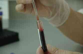 Cientistas americanos criaram um exame de sangue que detecta mutao gentica e protenas que atuam como marcadores em determinados tipos de cncer(foto: Pixabay)