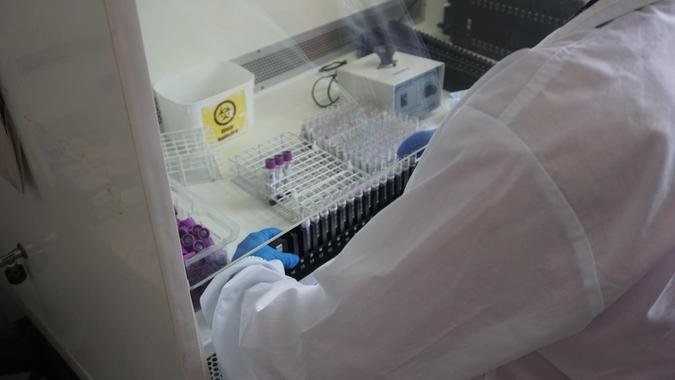 As medidas de prevenção incluem o uso regular de preservativos, a realização periódica de testes e o não compartilhamento de seringas ou materiais perfurocortantes(foto: Marina Morena / Funed) As medidas de prevenção incluem o uso regular de preservativos, a realização periódica de testes e o não compartilhamento de seringas ou materiais perfurocortantes(foto: Marina Morena / Funed)