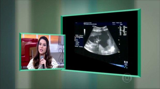Globotv.globo.com/Reprodução Globotv.globo.com/Reprodução