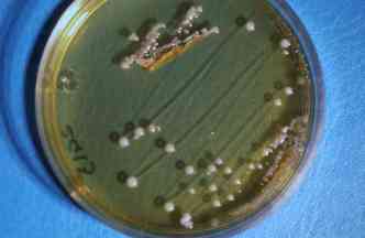 A bactria Lactobacillus crispatus, encontrada na vagina e no iogurte, pode ser usada para combater o vrus HIV(foto: Popsci.com/Reproduo)