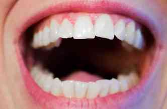 Como mostra a dentista, pessoas ansiosas tendem a sofrer com problemas bucais decorrentes do bruxismo e do hbito de roer unha(foto: Pixabay)