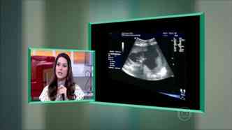 A atriz Fernanda Machado foi a um programa de TV para dizer que, mesmo sofrendo com a endometriose, conseguiu engravidar(foto: Globotv.globo.com/Reproduo)