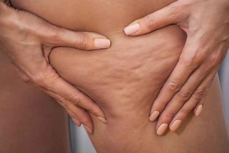 Health.clevelandclinic.org/Reprodução Health.clevelandclinic.org/Reprodução