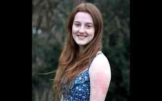 A jovem inglesa Lucy Pearce possui uma rara condio na pele, que fica inchada e marcada ao sofrer qualquer tipo de arranho(foto: Dailymail.co.uk/Caters News Agency/Reproduo)