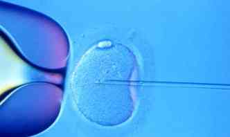 Apesar da resoluo do CFM liberar fertilizao in vitro para mulheres a partir de 50 anos, mdico recomenda cautela, devido aos riscos da gravidez nessa idade(foto: Myhealthblogs.com/Reproduo)
